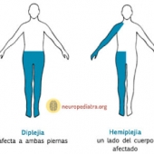 article-image